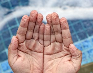 ΠΡΟΣOXH: Αν ζαρώνουν αμέσως τα δάχτυλά σας στο νερό τότε ίσως έχετε…