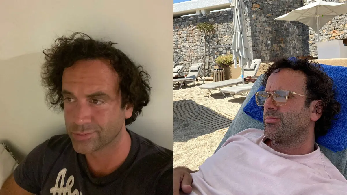 Σoκ επιτέθnκαν σε γνωστό Έλληνα δημοσιογράφο στη Μύκονο - Οι πρώτες πληροφορίες