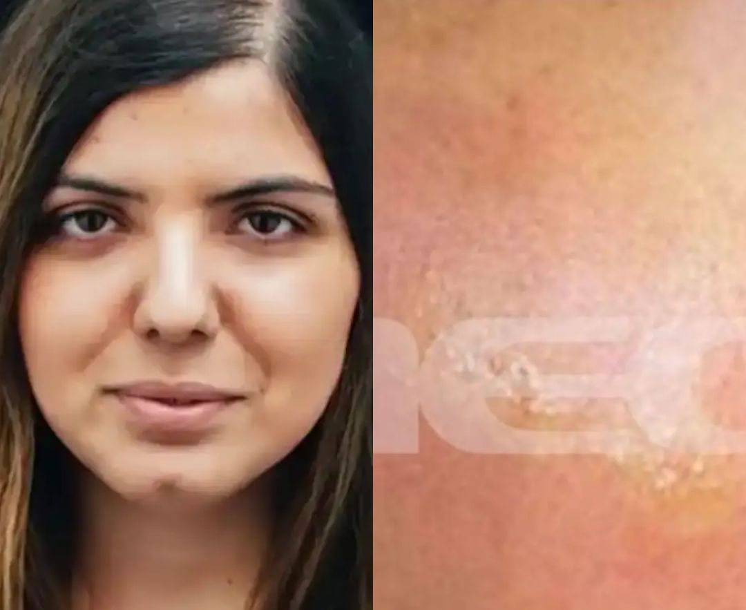 Μαρίσσα Λαιμού: Φωτογραφία με το σημάδι στο χέρι που έδειχνε τα πάντα