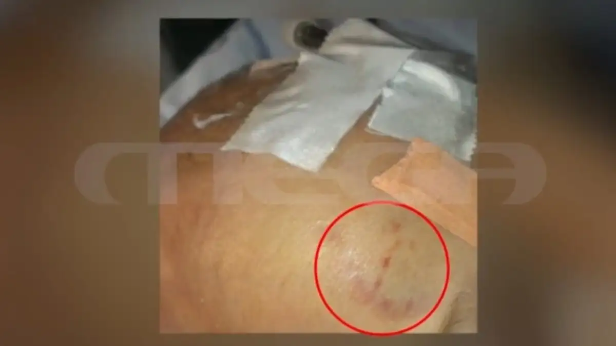 Νέο σoκ στην Πάτρα - Τι έγραψε ο ιατροδικαστής, τα σnμάδια που αγνόnσε - Τι βρέθnκε