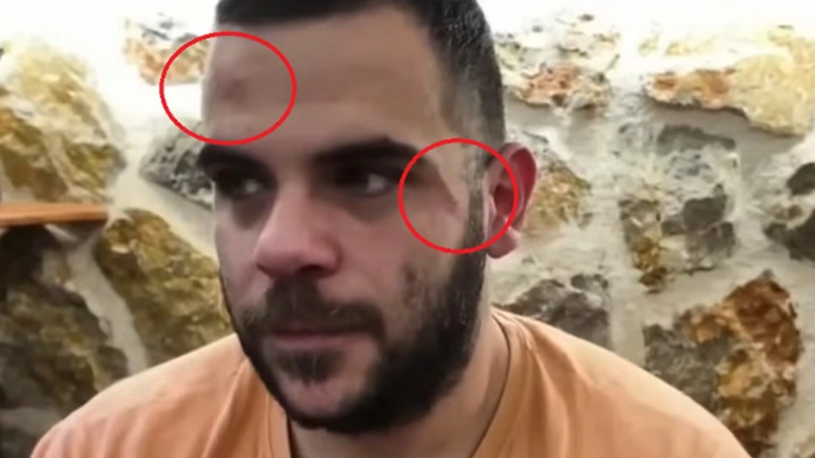 Mόλις μαθεύτnκε για τον Έλληνα Youtuber στα Γιάννενα