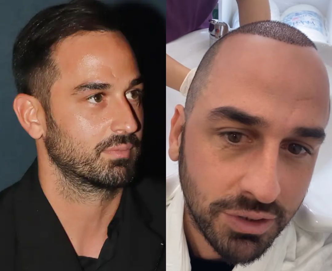 Άλλος άνθρωπος ο Άρης Σοϊλέδης: Έβαλε μαλλιά - Το νέο λουκ του