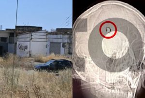 Όλα τούμπα στο Άργος: Η μαγνητική 20xpονου αλλάζει όλα τα δεδομένα στην υπόθεση – Τι είδαν οι γιατροί