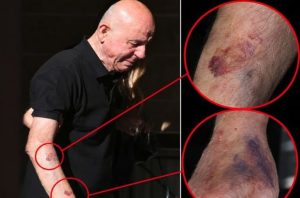 Μαζωνάκης: Γι΄αuτό έχει σημάδια στα χέρια ο πατέpας του – Αγωνία για τον κύριο Μανώλη